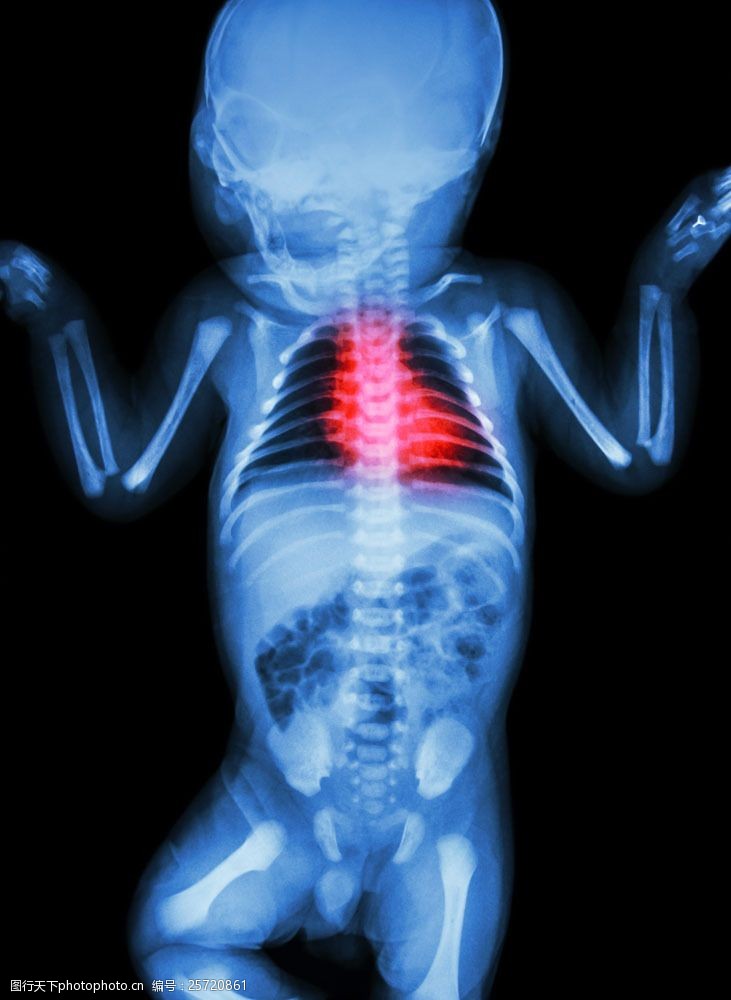 骨骼结构图儿童X光透视图图片