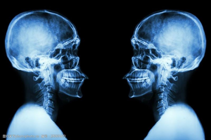 骨骼结构图X光脑部透视图图片