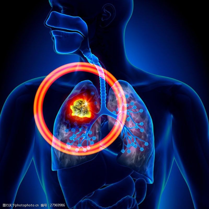 身体器官肺癌信号图片
