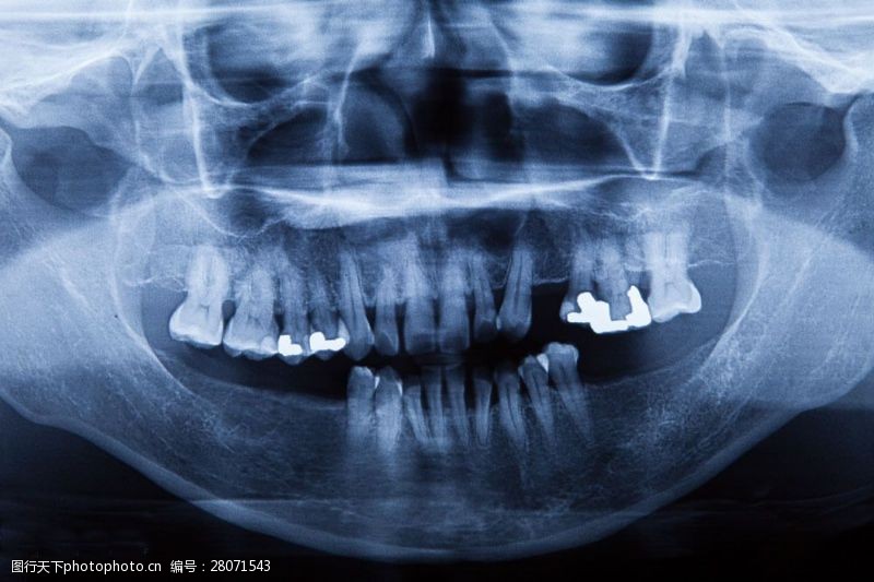 骨骼结构图牙齿X光片图片