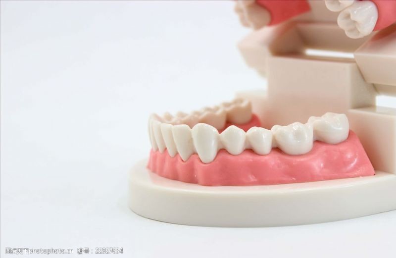 龋齿牙齿模型