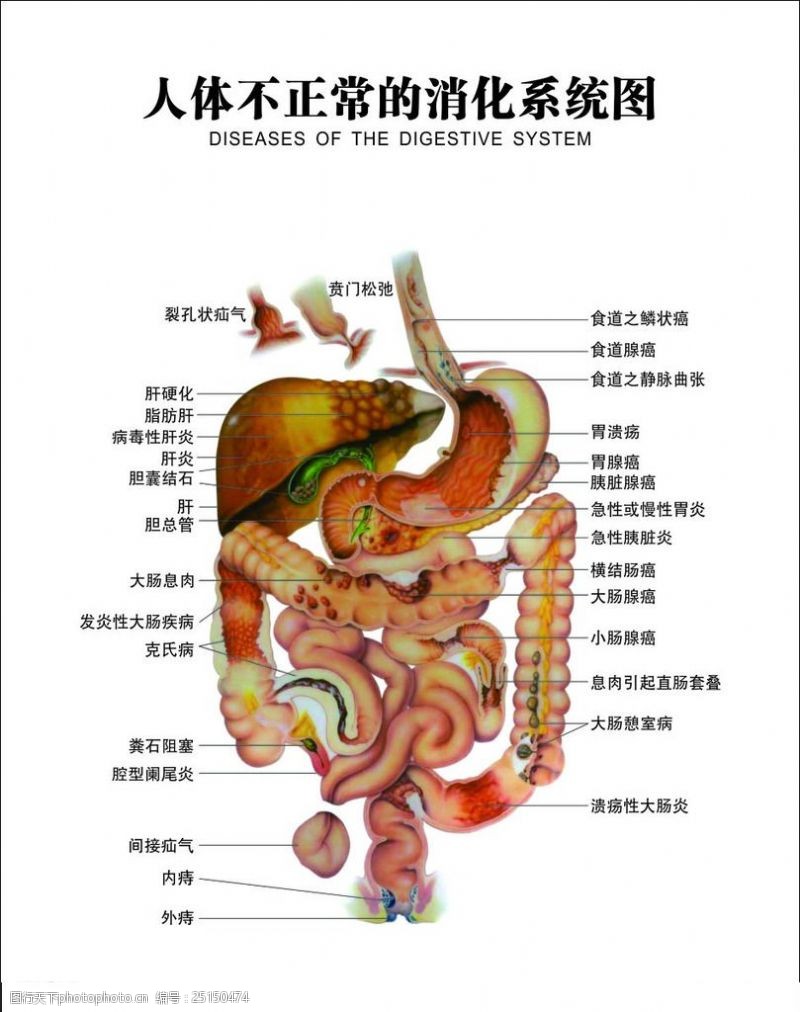 人体不正常的消化系统图